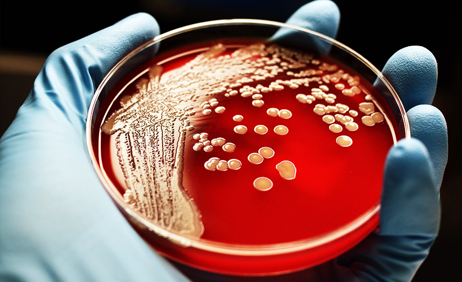 Hand eines Forschers hält Petrischale mit keimbelasteter Substanz.